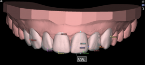 Wedding Smile DSD analysis